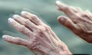 Khiếm khuyết vận động thường gặp ở người bệnh Parkinson Khiếm khuyết vận động thường gặp ở người bệnh Parkinson