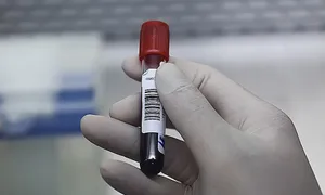 Nở rộ xét nghiệm tại nhà, nhờ 'bác sĩ quen' kê toa Nở rộ xét nghiệm tại nhà, nhờ 'bác sĩ quen' kê toa